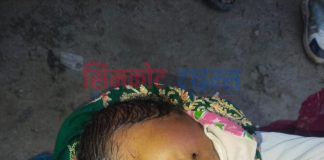 पैतीस दिनको बालक छतवाट लडाएपछि घाईते